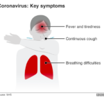 coronavirus-symptoms-